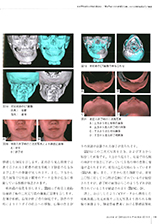 JOP/矯正臨床ジャーナル　2016年9月号