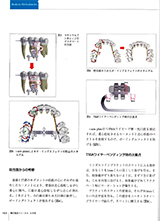 JOP/矯正臨床ジャーナル　2016年9月号