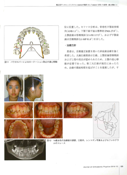 JOP/矯正臨床ジャーナル　2016年10月号