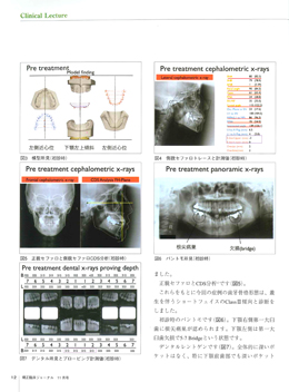 JOP/矯正臨床ジャーナル　2016年11月号