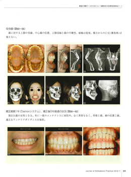 JOP/矯正臨床ジャーナル　2016年11月号
