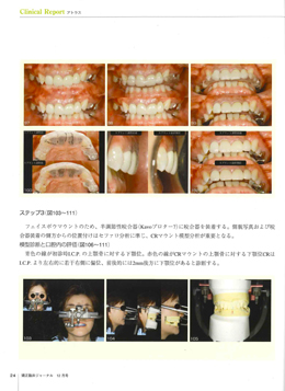 JOP/矯正臨床ジャーナル　2016年12月号