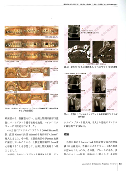 JOP/矯正臨床ジャーナル　2016年12月号