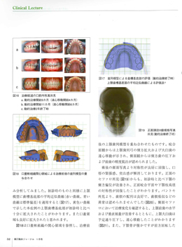 JOP/矯正臨床ジャーナル　2017年1月号