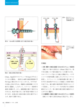 JOP/矯正臨床ジャーナル　2017年2月号