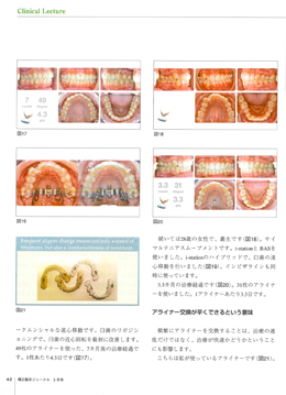 JOP/矯正臨床ジャーナル　2017年3月号