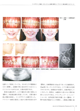 JOP/矯正臨床ジャーナル　2017年5月号