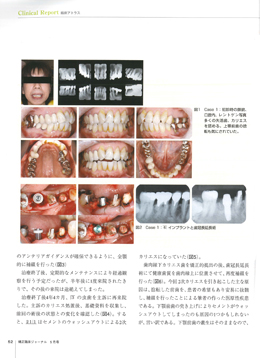 JOP/矯正臨床ジャーナル　2017年5月号