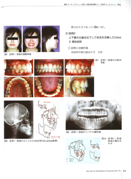 JOP/矯正臨床ジャーナル　2017年6月号