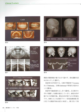 JOP/矯正臨床ジャーナル　2017年7月号