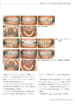 JOP/矯正臨床ジャーナル　2017年8月号