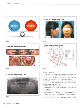 JOP/矯正臨床ジャーナル　2017年9月号