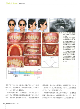 JOP/矯正臨床ジャーナル　2017年9月号