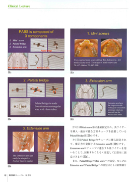 JOP/矯正臨床ジャーナル　2017年10月号