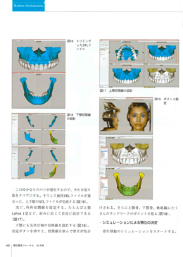 JOP/矯正臨床ジャーナル　2017年10月号