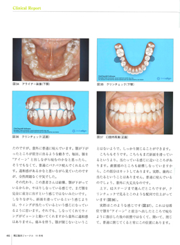 JOP/矯正臨床ジャーナル　2017年11月号