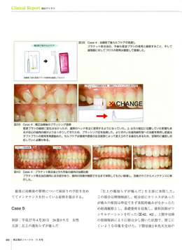 JOP/矯正臨床ジャーナル　2017年11月号