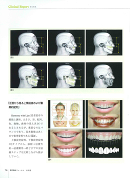 JOP/矯正臨床ジャーナル　2017年12月号