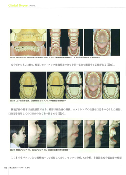 JOP/矯正臨床ジャーナル　2018年1月号