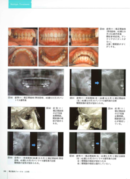 JOP/矯正臨床ジャーナル　2018年2月号