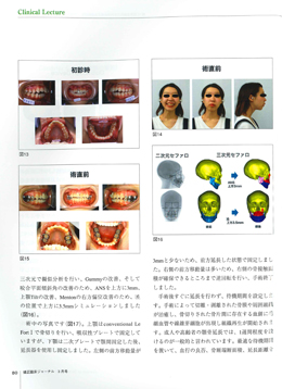 JOP/矯正臨床ジャーナル　2018年3月号