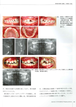 JOP/矯正臨床ジャーナル　2018年3月号