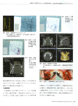 JOP/矯正臨床ジャーナル　2018年4月号