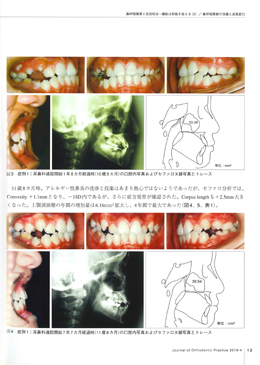 JOP/矯正臨床ジャーナル　2018年4月号