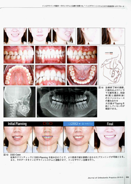 JOP/矯正臨床ジャーナル　2018年5月号