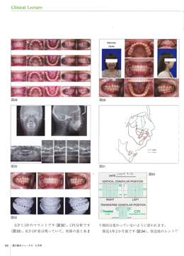 JOP/矯正臨床ジャーナル　2018年6月号