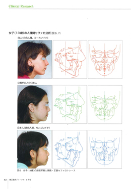 JOP/矯正臨床ジャーナル　2018年6月号