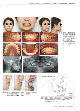 JOP/矯正臨床ジャーナル　2018年7月号