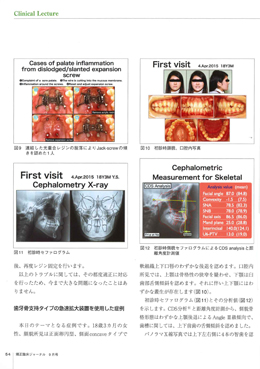 JOP/矯正臨床ジャーナル　2018年9月号