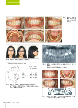 JOP/矯正臨床ジャーナル　2018年10月号