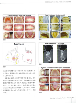 JOP/矯正臨床ジャーナル　2018年10月号