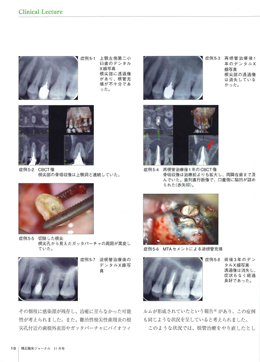 JOP/矯正臨床ジャーナル　2018年11月号