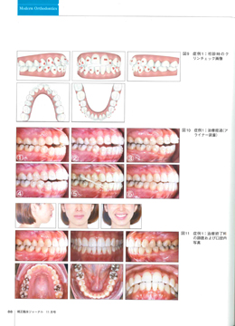 JOP/矯正臨床ジャーナル　2018年11月号