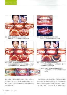 JOP/矯正臨床ジャーナル　2018年12月号