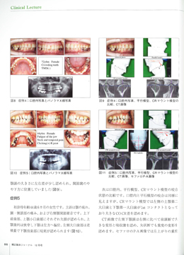 JOP/矯正臨床ジャーナル　2018年12月号