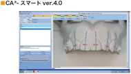 CA®- スマートver.4.0