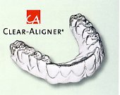 CLEAR-ALINGNER