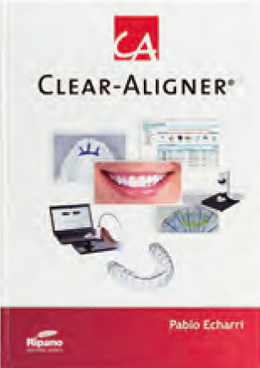 Ca Clear-Aligner <英語版>