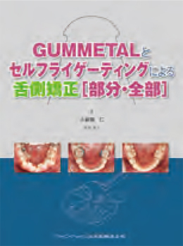 GUMMETALとセルフライゲーティングによる舌側矯正［部分・全部］