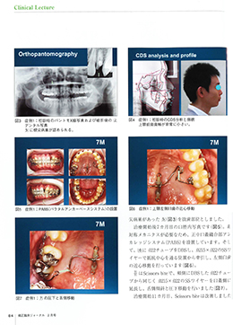 JOP/矯正臨床ジャーナル　2019年2月号