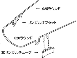 3Dリンガルアーチ