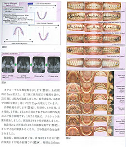 JOP/矯正臨床ジャーナル　2019年3月号