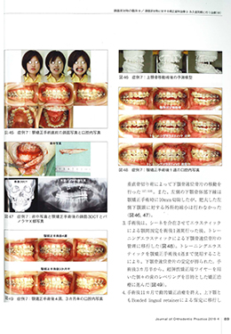 JOP/矯正臨床ジャーナル　2019年4月号