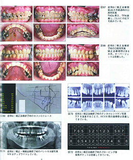 JOP/矯正臨床ジャーナル　2019年7月号