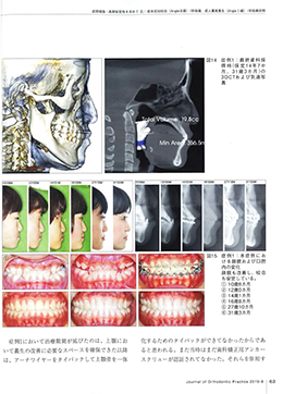 JOP/矯正臨床ジャーナル　2019年8月号