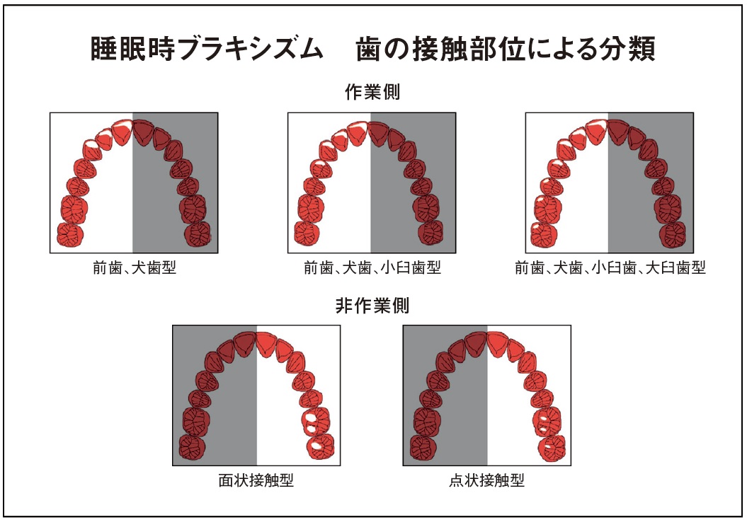 アプライアンス